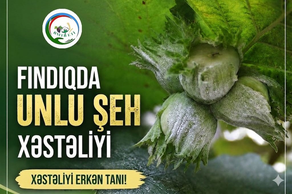 FINDIQDA UNLU ŞEH XƏSTƏLİYİ